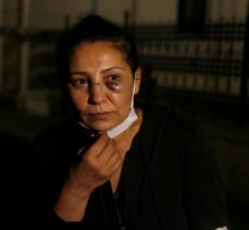 Serviste tartıştığı kadını darbettiği iddia edilen kişi gözaltına alındı