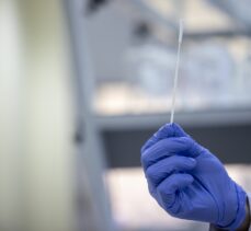 Türk bilim insanları, koronavirüs teşhisini 10 saniyeye düşüren, PCR'ın yerini almaya aday tanı sistemi geliştirdi