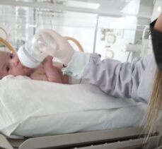 Samsun'da bağırsak tıkanıklığı ile doğan bebek ameliyatla sağlığına kavuştu