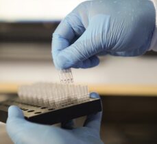 Mikrobiyologlardan aşı sonrası antikor testlerinde güvenilirlik uyarısı