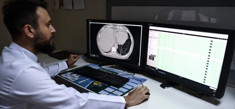 Bilgisayarlı tomografide Kovid-19'u 50 saniyede tespit edebilen yapay zeka yazılımı geliştirildi