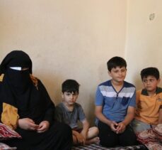 Savaş mağduru Suriyeli kadının görmeyen gözleri, Türkiye'de ışığa kavuştu