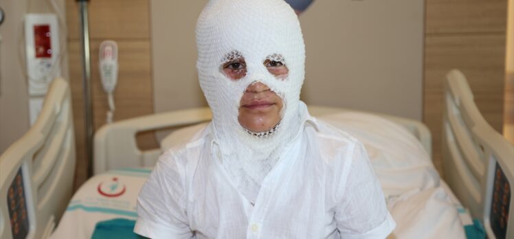 Arkadaşının yaktığı kolonyayı söndürürken yanan çocuk Erzurum'da tedaviye alındı