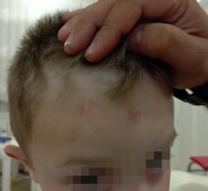 Karabük'te sokak köpeklerinin saldırısına uğrayan çocuk yaralandı