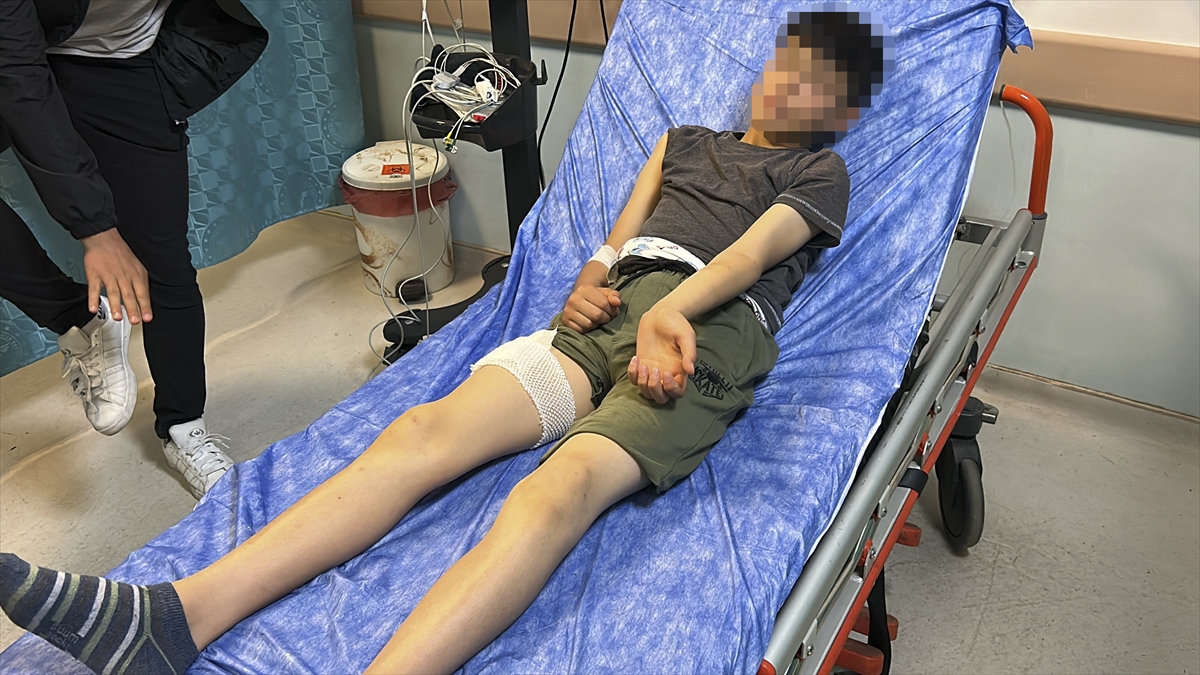 Sivas'ta sahipsiz köpeğin saldırdığı çocuk yaralandı